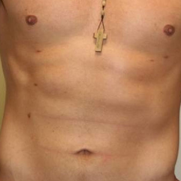 abdomen hombre D